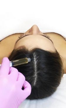 Мезотерапия для волос: что это такое и для чего нужно