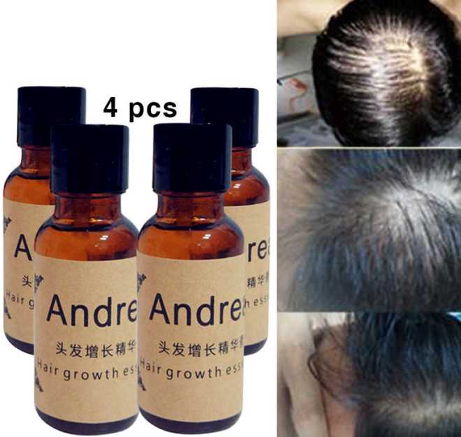 Особенности средства для роста волос Аndrea