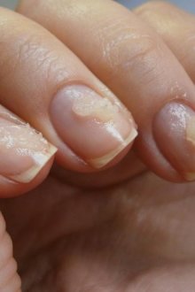 Как восстановить ногти после гель-лака