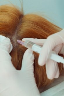 Возможна ли мезотерапия волос в домашних условиях